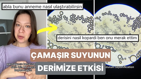 Mikroskopta İlginç İncelemeler Kadın Şimdi de Çamaşır Suyunun İnsan Derisine Etkisini Kendi Derisiyle İnceledi