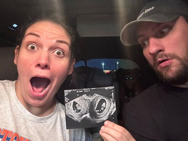 ABD'nin Alabama eyaletinde yaşayan Kelsey Hatcher isimli kadın, çok nadir görülen bir hamilikle tüm dünyayı şok etti. Çift rahmi bulunan kadın, iki bebeğini doğurdu.