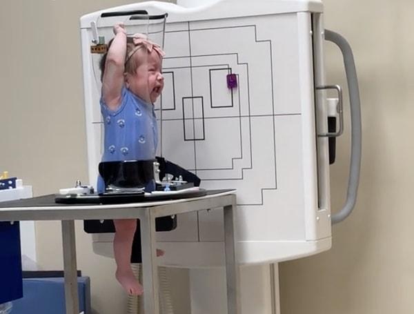 Bebeklere röntgen çekilirken Pigg-O-Stat adı verilen bir cihaz kullanılıyor.