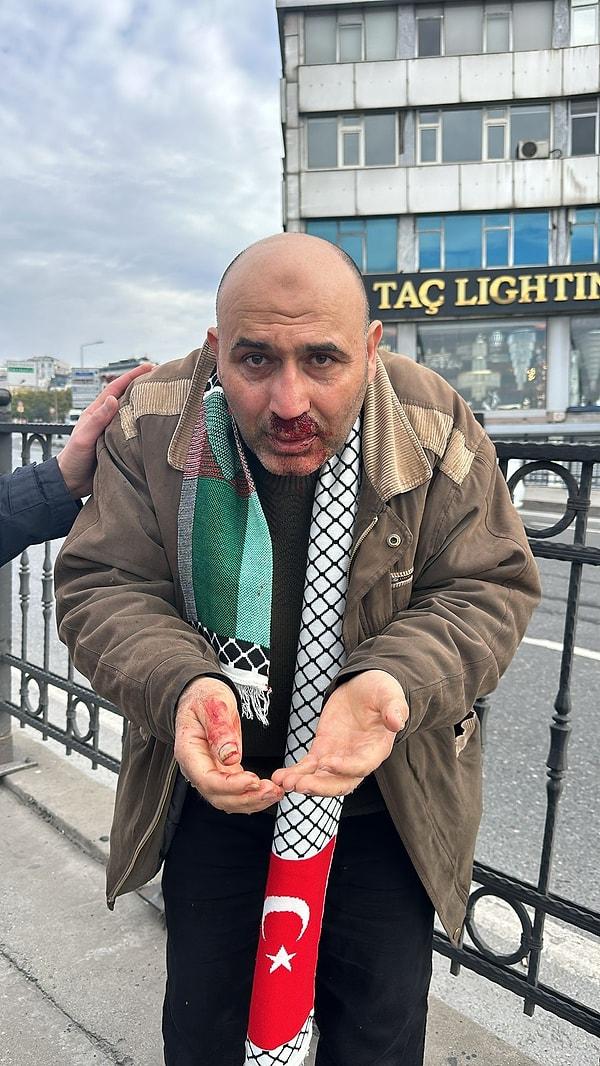 Kelime-i Tevhid bayrağı açtığı için saldırıya uğradığı iddia edilen 48 yaşındaki İsmail Aydemir'in saldırı sonrası anları ise çevrede bulunanların cep telefonu ile görüntülendi.
