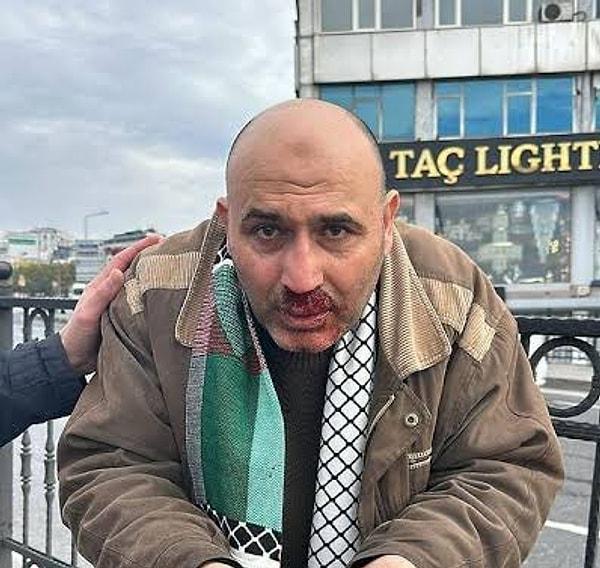 İstanbul'da gerçekleşen “Şehitlere rahmet Filistin'e destek” yürüyüşüne katılan İsmail Aydemir adlı bir kişinin hilafet bayrağı açtığı için yumruklu saldırıya uğradığı iddia edilmişti.