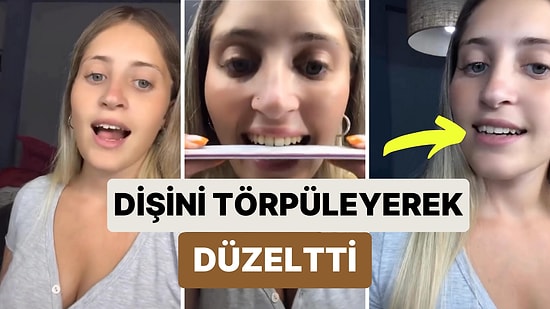 Uzun Olan Dişini Dişçiye Gitmek Yerine Günlerce Törpüleyen Kadının O Anlarını İzlerken Rahatsız Olacaksınız