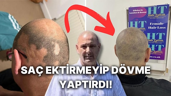 Depresyon Yüzünden Kelleştiğini Fark Ettikten Sonra Saçına Dövme Yaptıran Adamın Göz Dolduran Hikayesi