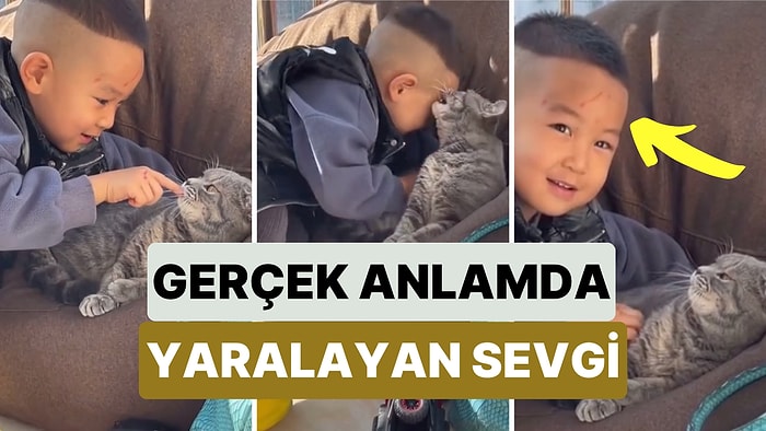 Yüzünde Açtığı Yaralara Rağmen Kedisinden Vazgeçemeyen Miniğin Sevgisi Size 'Birini' Hatırlatacak