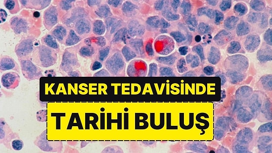 Bilim Dünyasında Tarihi Buluş: Kemoterapiye Alternatif Kanser Tedavisi Geliştirildi