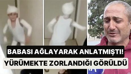 Ankara'da Başıboş Sokak Köpeklerinin Saldırısına Uğrayan Tunahan'ın Son Halini Babası Paylaştı
