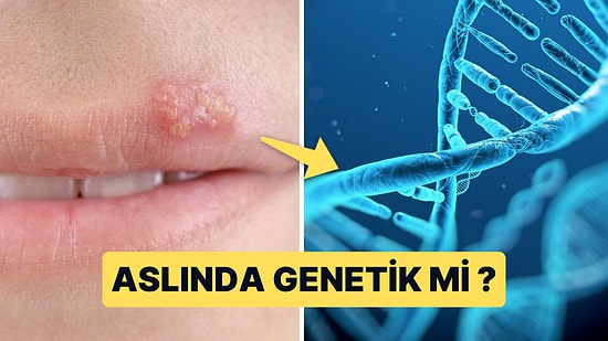 Uçuk Virüsü Oluşumunda Genetik Faktörler Rol Oynuyor mu?