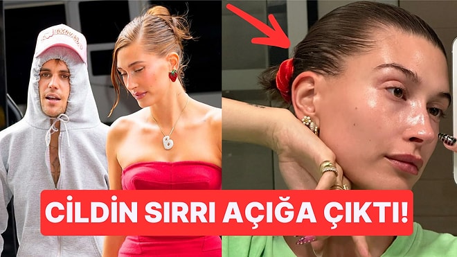 Hailey Bieber'ın Cam Gibi Işıldayan Cildi Bir Kez Daha 'Paranın Gözü Kör Olsun' Dedirtti!