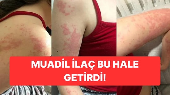 Eczacının Verdiği İlaç Otizmli Zeynep'in Kabusu Oldu: Olay Yargıya Taşındı