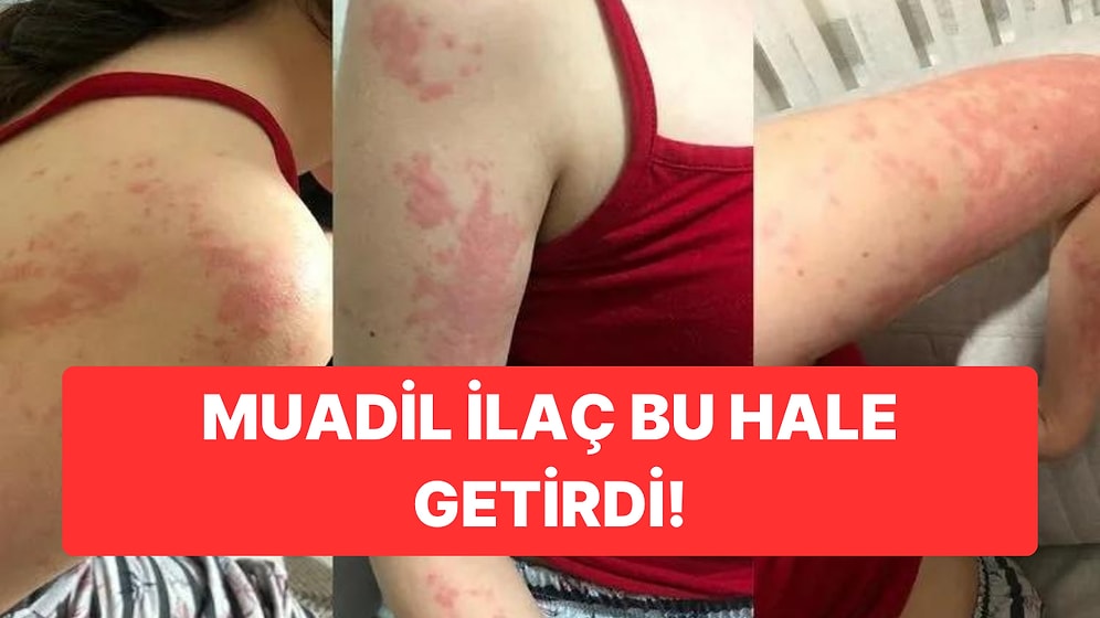 Eczacının Verdiği İlaç Otizmli Zeynep'in Kabusu Oldu: Olay Yargıya Taşındı