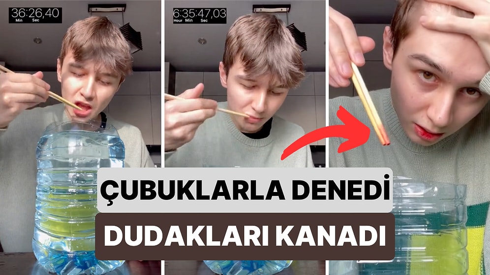 Çatalla 5 Litre Suyu Bitirmeye Çalış Genç Aynısını Çubuklarla Deneyince Dudakları Kanadı