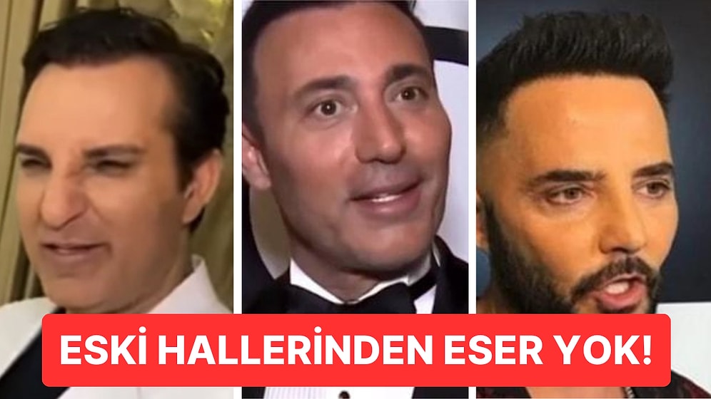 Son Dönemde Yaptırdıkları Estetik İşlemlerle Gündeme Gelen Ünlü İsimler