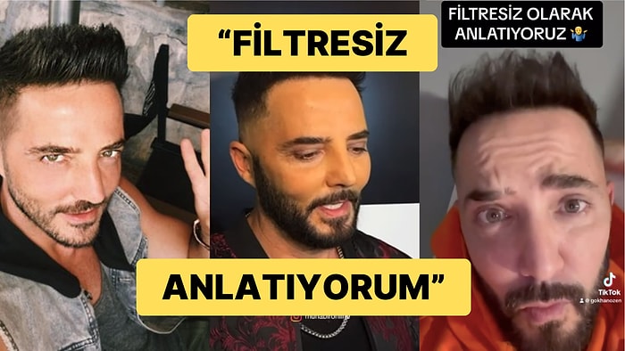 Gökhan Özen Estetik Haberlerini Kaşlarını Kaldırarak Yalanladı: "Benim Keyfimi Böyle Kaçıramazsınız"