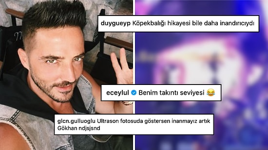 Tamam Kesin İnandık: Estetik İddialarına Katlanamayan Gökhan Özen Çocukluk Fotoğrafını Kanıt Olarak Sundu