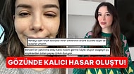 İpek Kirpik Yüzünden Korneası Parçalanan Influencer Güzellik Merkezlerine Tövbe Etmenize Neden Olacak