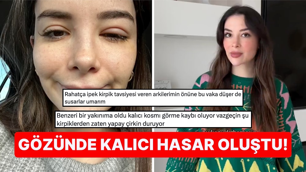 İpek Kirpik Yüzünden Korneası Parçalanan Influencer Güzellik Merkezlerine Tövbe Etmenize Neden Olacak