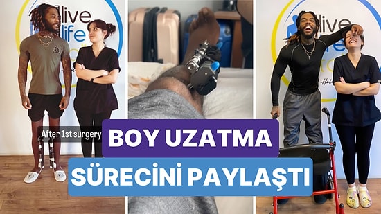 Boy Uzatma Operasyonunun Tüm Detaylarını Paylaşan Genç Akıllara Tek Bir Soru Getirdi: Gerçekten Değer mi?