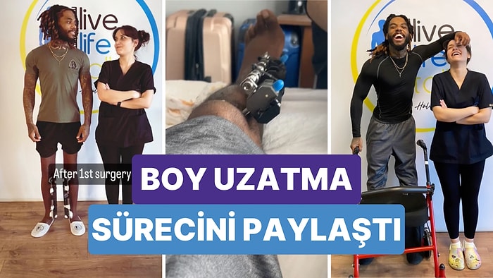 Boy Uzatma Operasyonunun Tüm Detaylarını Paylaşan Genç Akıllara Tek Bir Soru Getirdi: Gerçekten Değer mi?