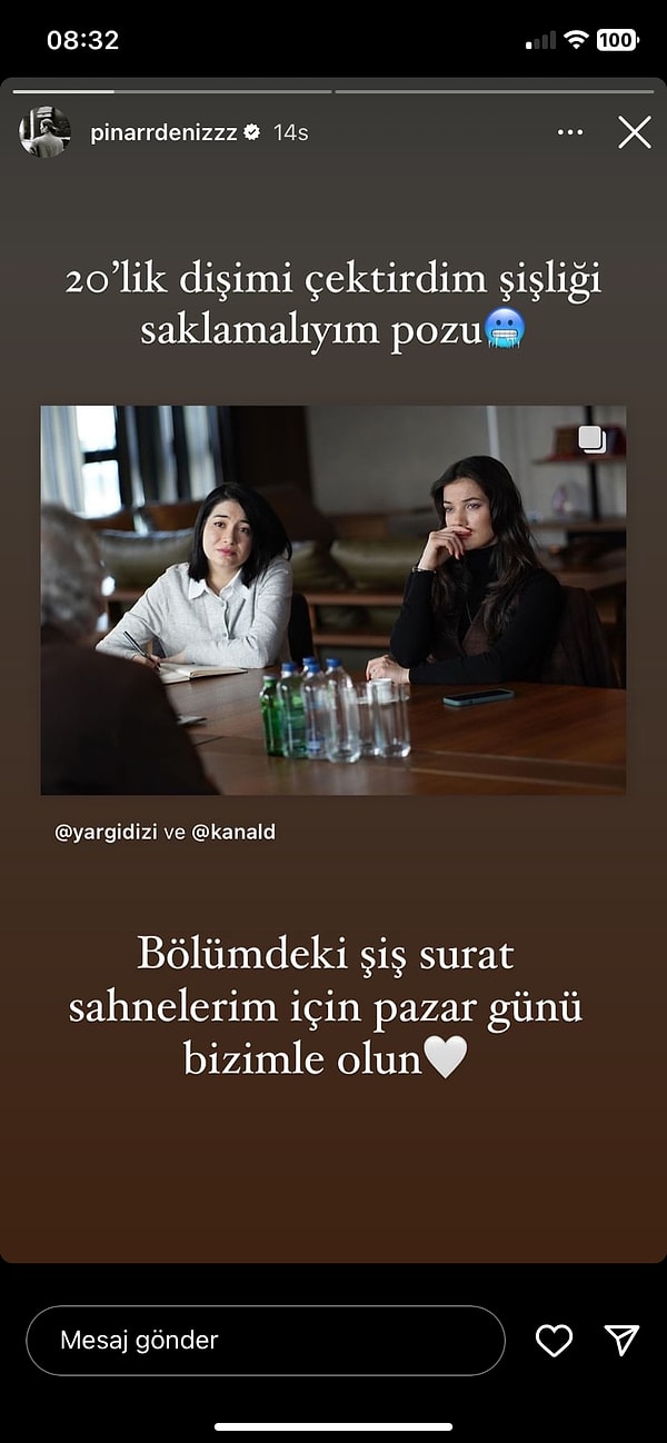 Güzel oyuncu yayınlanan son bölüm öncesi resmi hesapta paylaşılan bu fotoğrafını yeniden paylaşarak 20'lik dişini çektirdiğini ve bölüm boyunca yüzündeki şişliği saklamaya çalıştığını duyurdu.