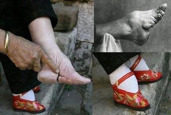 3. "Asya ülkelerinde bulunan geleneksel ayak düğümlemesi. Eskiden kadınlar arasında güzellik standartı olarak bilinen, ayakların kemikler kırılıncaya kadar sıkıca bağlandığı ve küçültüldüğü bir gelenektir bu. Bundan daha korkutucu bir güzellik anlayışı var mı bilmiyorum."