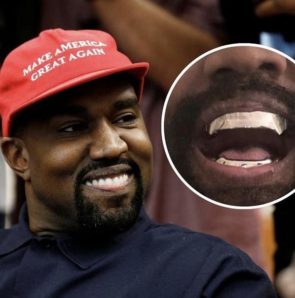 Kanye West geçtiğimiz günlerde bütün dişlerini söktürüp yerine 850 bin dolar değerinde titanyum ile kaplatmıştı hatırlarsanız.