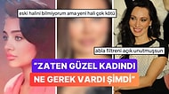 Estetik Yaptırma Konusunda Dur Durak Bilmeyen Yerli Angelina Jolie'miz Umut Akyürek Son Halini Paylaştı