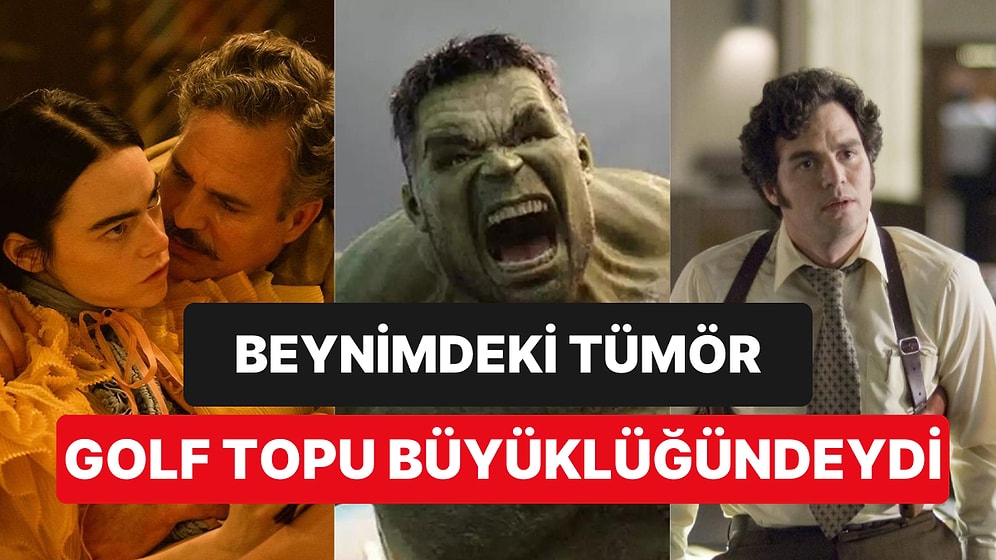 Avengers Yıldızı Ünlü Oyuncu Beyninde Tümör Olduğunu Rüyasında Gördüğünü Söylemesiyle Herkesi Üzdü