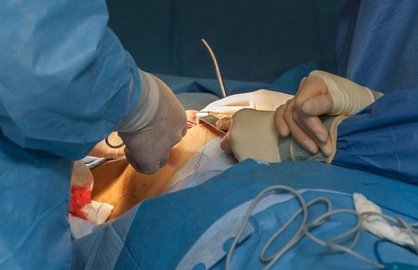 Göğüs ameliyatları son zamanlarda hem Türkiye'de hem de dünya çapında en çok rağbet gören operasyonlardan bir tanesi. İnsanlar, sağlık problemleri ve estetik görüntü için bu operasyona başvurabiliyor.