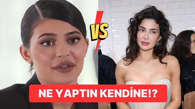 Kylie Jenner Fazla Botoks Sonucu Tamamen Çöken Yüz Hatlarıyla Bir Kez Daha Gündeme Geldi