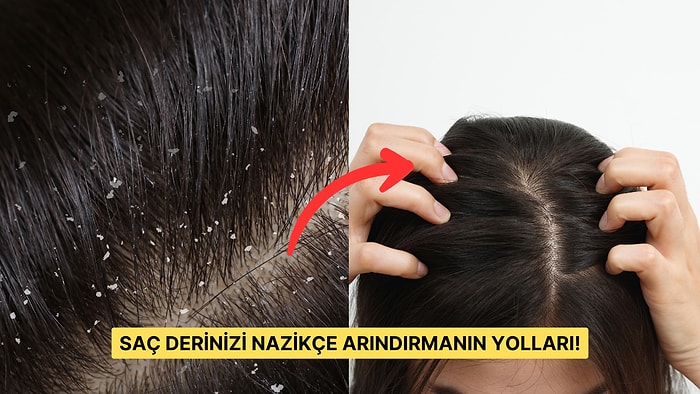 Saç Derinizi Zımparalar Gibi Kaşımak Yerine Bu 15 Ürünü Kullanarak Sorunu Kökten Çözün