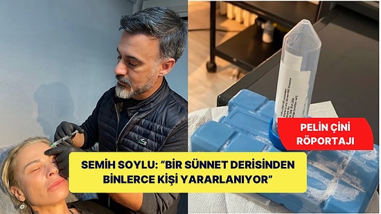 Kök Hücre, Fibroblast ve Alloblast ile "Bir Sünnet Derisinden Binlerce Kişi Yararlanıyor"