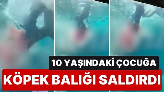 Ailesiyle Gittiği Tatilde Köpek Balığı Havuzuna Dalış Yapan 10 Yaşındaki Çocuğa Köpek Balığı Saldırdı