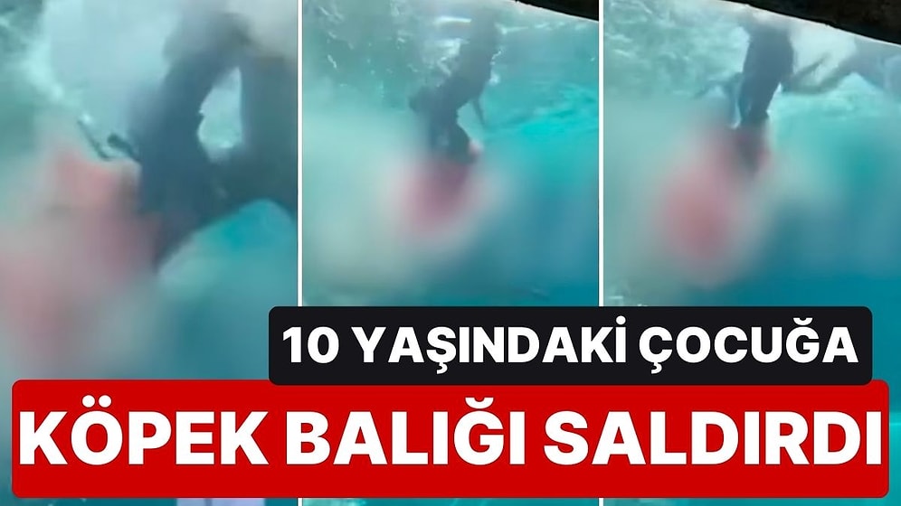 Ailesiyle Gittiği Tatilde Köpek Balığı Havuzuna Dalış Yapan 10 Yaşındaki Çocuğa Köpek Balığı Saldırdı