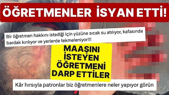 Maaşını İsteyen Öğretmeni Darp Ettiler! Olay, Sosyal Medyada Tepki Çekti