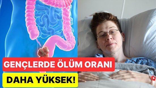 Yeni Bir Araştırmaya Göre Sağlıksız Beslenme Bağırsak Kanserinden Kaynaklanan Ölüm Riskini Arttırıyor!