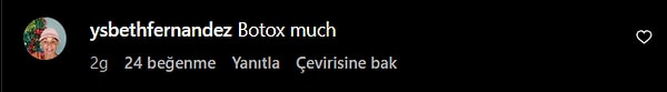 Çok fazla geçirdiği estetik operasyonlardan ötürü "Botoks fazla mı" diyen olmuş.