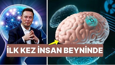Bu da Oldu! Elon Musk'ın Neuralink Şirketi İlk Kez Bir İnsanın Beynine Çip Yerleştirdi!