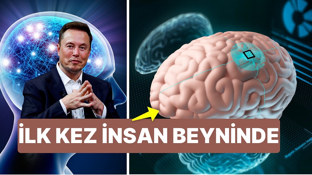 Bu da Oldu! Elon Musk'ın Neuralink Şirketi İlk Kez Bir İnsanın Beynine Çip Yerleştirdi!