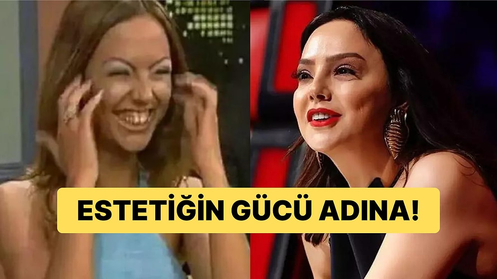 Küllerinden Adeta Yeniden Doğan Ünlü İsimler 'Estetik Sen Nelere Kadirsin!' Dedirtti