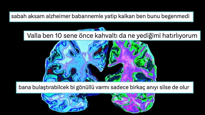 Alzheimer'ın İnsandan İnsana Bulaşabileceğini Öğrenen Twitter Kullanıcılarının Birbirinden Enteresan Tepkileri