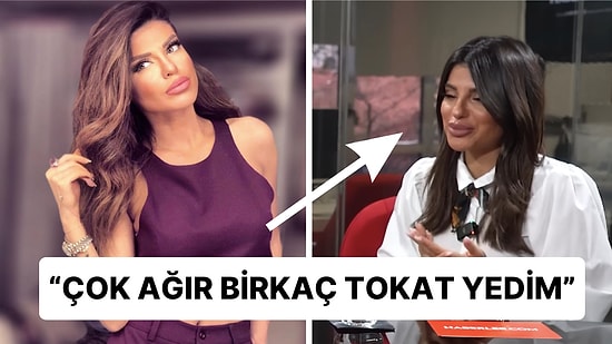 Bircan Bali Çarpıcı Açıklamalarda Bulundu: "Dar Pantolon Giydiğim İçin Eski Sevgilimden Şiddet Gördüm"