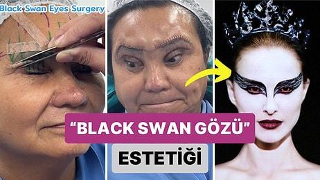 Bir Kadının Geçirdiği "Black Swan Gözü" Olarak Bilinen Estetik Operasyonun Ardından Yaşadığı İlginç Değişim