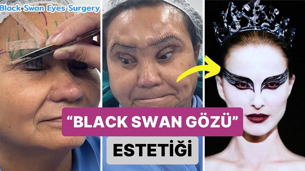 Bir Kadının Geçirdiği "Black Swan Gözü" Olarak Bilinen Estetik Operasyonun Ardından Yaşadığı İlginç Değişim