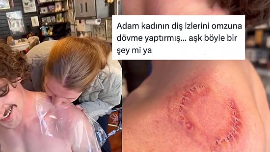 Sevgilisinin Diş İzlerini Omzuna Dövme Yaptıran Adam Aşk Kavramını Yeniden Sorgulattı