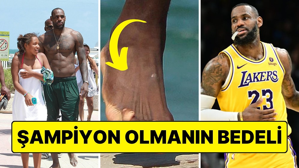 LeBron James'in Her Biri Farklı Yere Bakan Ayak Parmakları Yeniden Sosyal Medyanın Dilinde