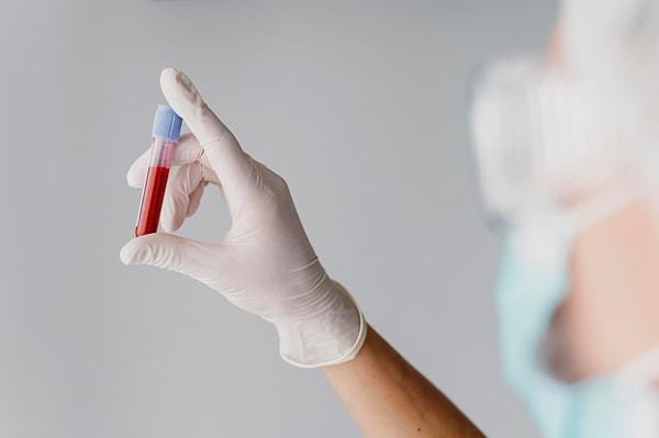 Kolestrolünüz olup olmadığını öğrenme yolu ise basit: Kan testi