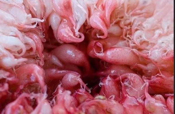 Sosyal medyada dolaşan "kadın vajinasının mikroskopla çekilmiş görüntüsü" birçok kişinin bu yüzden kafasını yakmış olabilir.