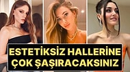Gençlik (Estetiksiz) Halleriyle Şimdiki Halleri Arasında Dağlar Kadar Fark Olan Ünlülerin Şaşırtan Değişimleri
