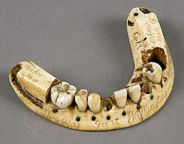 10. Protezler icat edilmeden önce protez olarak kullanılmak üzere ölü askerlerin ağzından dişler çekilirdi.