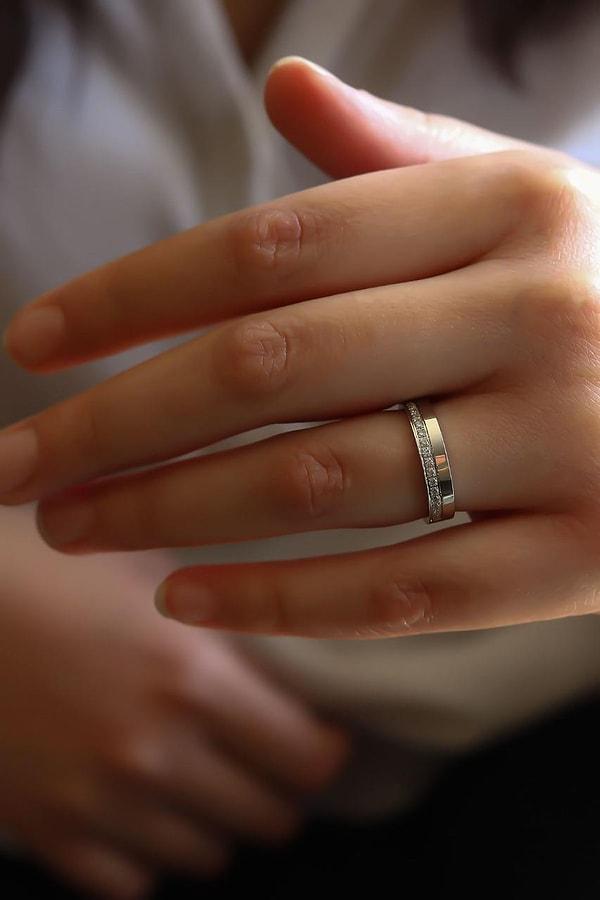 Doktor paylaşımında, muayeneye gelen hastasının yüzüğünü yuttuğunu yazdı.